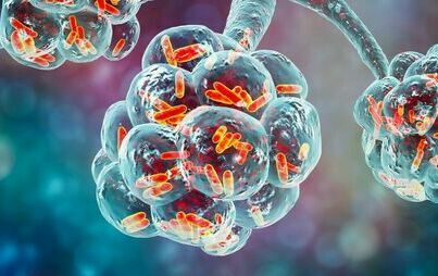Zdjęcie do Komunikaty w sprawie bakterii Legionella